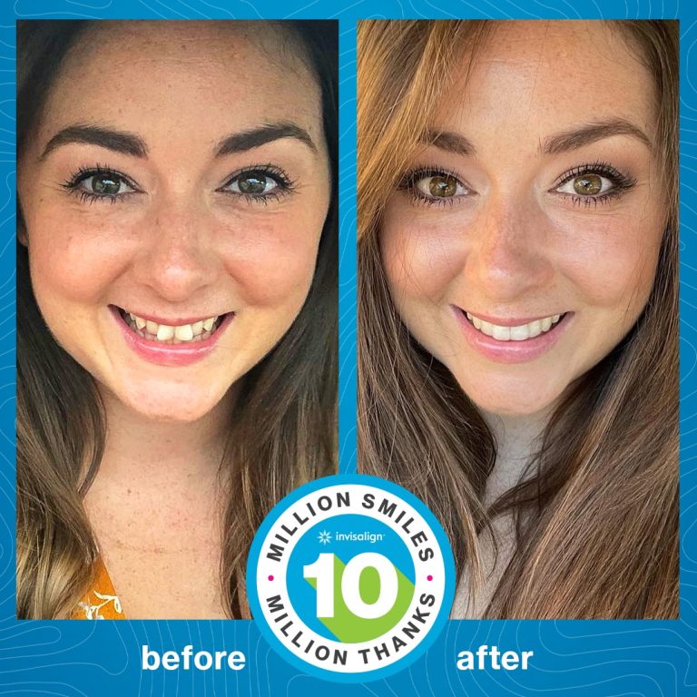 Radiance Dental Center invisalign tanger 1
