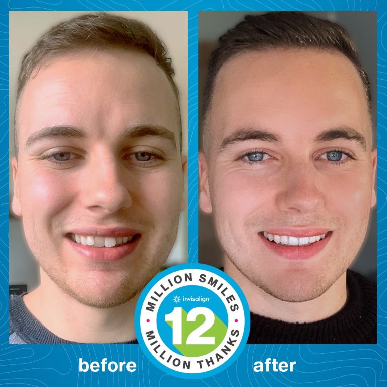 Radiance Dental Center invisalign tanger 2