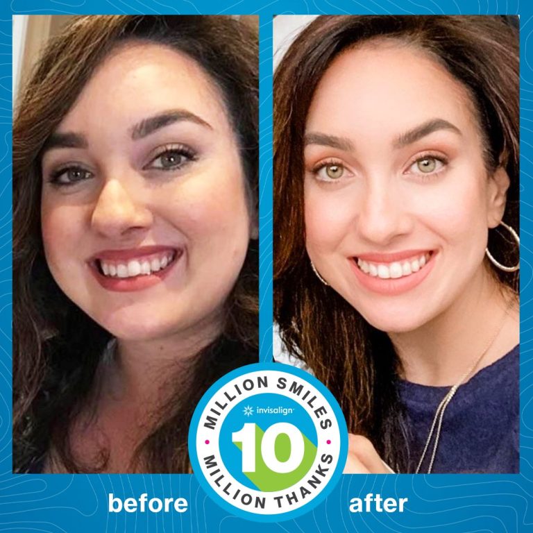 invisalign maroc